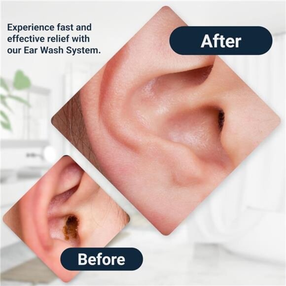 Wax-Rx Ph Conditioned Ear Wash System, 15.2 Ounce - Picture 6 of 8